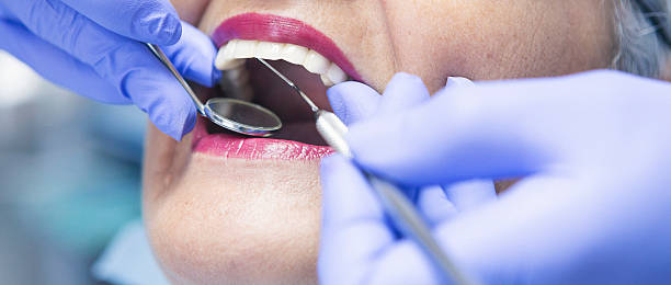 Best Emergency Root Canal Treatment in Adel, IA
